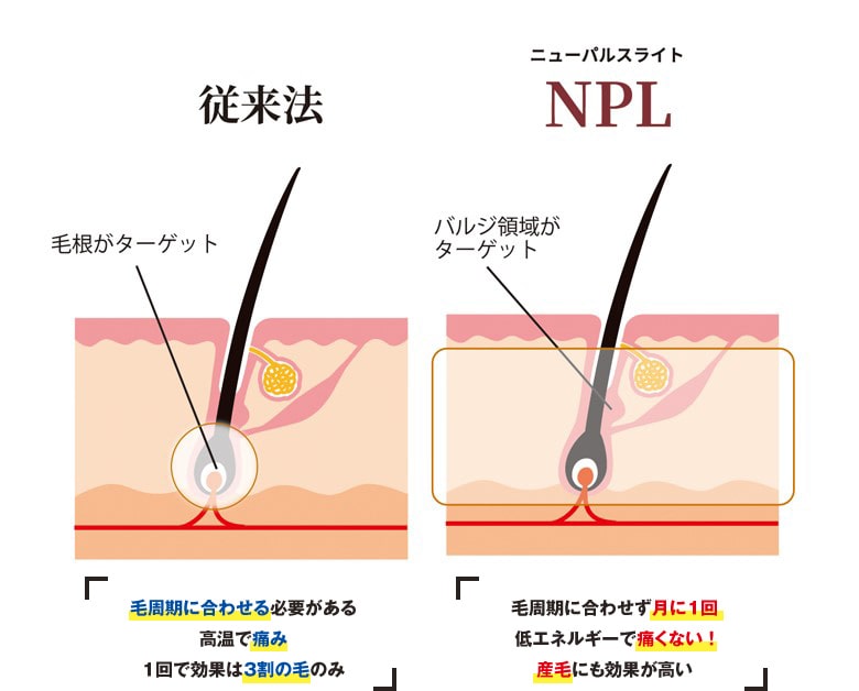 最新 業務用エステ脱毛 Rioxyvictoria ヴィクトリア エステ美容機器の製造 販売 Shemen シーメン